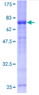 SDS-PAGE (IRF1-5046H).jpg